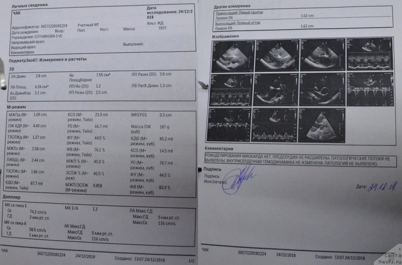 Фото: ньюфаундленд Смигар Агдай Виртус (Smigar Agday Virtus)