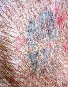 Превью фото № 129419