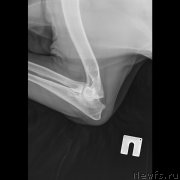 Превью фото № 198175